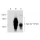 L-type Ca++ CP β3 Antibody (7D1) - Western Blotting - Image 139478 