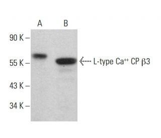 L-type Ca<sup>++</sup> CP &beta;3 Antibody (7D1) - Western Blotting - Image 379066 