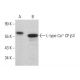 L-type Ca++ CP β3 Antibody (7D1) - Western Blotting - Image 379066 