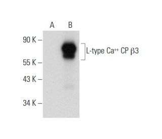 L-type Ca<sup>++</sup> CP &beta;3 Antibody (E-10) - Western Blotting - Image 311999