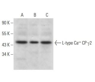 L-type Ca<sup>++</sup> CP &gamma;2 Antibody (D-7) - Western Blotting - Image 318462 