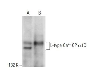 western blotting image from recommended L-type Ca++ CP &alpha;1C (D-6) monoclonal antibody replacement. Image 304477