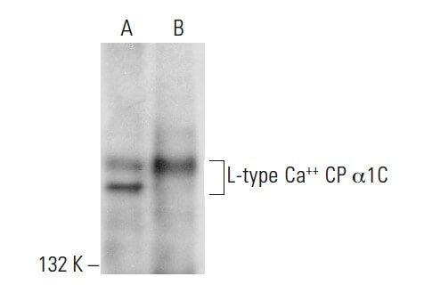 L-type Ca++ CP α1C抗体(A-20) | SCBT - Santa Cruz Biotechnology