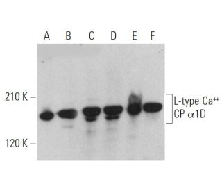 western blotting image from recommended L-type Ca++ CP &alpha;1D (E-3) monoclonal antibody replacement. Image 370137
