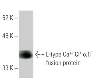 L-type Ca<sup>++</sup> CP &alpha;1F Antibody (1H6) - Western Blotting - Image 348447