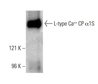 L-type Ca<sup>++ </sup>CP &alpha;1S Antibody (IIC12D4) - Western Blotting - Image 4598