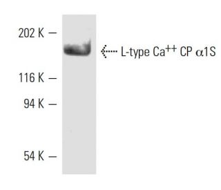 L-type Ca<sup>++</sup> CP &alpha;1S Antibody (IIF71VH3) - Western Blotting - Image 9216