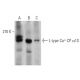 This polyclonal antibody has been discontinued. See our recommended <a href="l-type-ca-cp-alpha1s-antibody-g-1">L-type Ca<sup>++</sup> CP α1S (G-1)</a> monoclonal antibody (sample data shown). western blotting image from recommended L-type Ca++ CP α1S (G-1) monoclonal antibody replacement. Image 359460