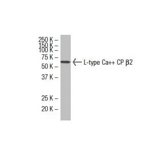 L-type Ca<sup>++</sup> CP &beta;2 Antibody (F-29) - Western Blotting - Image 33540