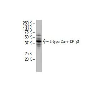 L-type Ca<sup>++</sup> CP &gamma;3 Antibody (A-07) - Western Blotting - Image 33539 