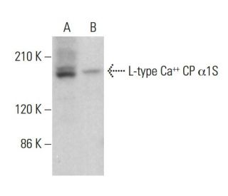 L-type Ca<sup>++</sup> CP &alpha;1S Antibody (G-1) - Western Blotting - Image 383921Each CRISPR/Cas9 Knockout (KO) Plasmid product consists of a pool of 3 plasmids designed to ensure identification and cleavage of a specific gene for maximum knockout efficiency. Each plasmid encodes a unique 20 nt sequence derived from the GeCKO (v2) library. 
