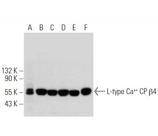 L-type Ca<sup>++</sup> CP β4 Antibody (H-7) - Western Blotting - Image 320925