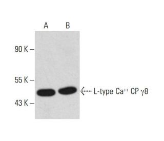 L-type Ca<sup>++</sup> CP γ8 Antibody (A-8) - Western Blotting - Image 320457Each CRISPR/Cas9 Knockout (KO) Plasmid product consists of a pool of 3 plasmids designed to ensure identification and cleavage of a specific gene for maximum knockout efficiency. Each plasmid encodes a unique 20 nt sequence derived from the GeCKO (v2) library.