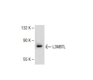 L3MBTL Antibody (D-9) - Western Blotting - Image 113859 