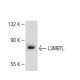 L3MBTL Antibody (D-9) - Western Blotting - Image 113859 