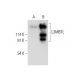 L3MBTL Antibody (D-9) - Western Blotting - Image 306539
