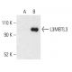 L3MBTL3 Antibody (F-9) - Western Blotting - Image 403693
