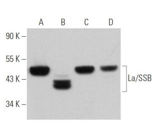 La/SSB Antibody (22A) - Western Blotting - Image 362330 