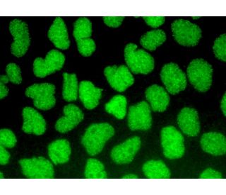 Anti-La/SSB Antibody (312B) | SCBT - Santa Cruz Biotechnology