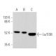 Anti-La/SSB Antibody (312B) | SCBT - Santa Cruz Biotechnology