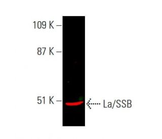 Anti-La/SSB Antibody (312B) | SCBT - Santa Cruz Biotechnology