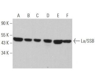 western blotting image from recommended La/SSB (312B) monoclonal antibody replacement. Image 368316