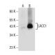 LACC1 Antibody (E-12) - Western Blotting - Image 154822