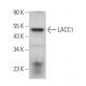 LACC1 Antibody (E-7) - Western Blotting - Image 364029