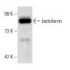 lactoferrin Antibody (a-bC-lobe) - Western Blotting - Image 45345