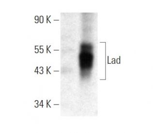 Lad Antibody (H-3) - Western Blotting - Image 382023 