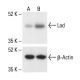 Lad Antibody (H-3) - Western Blotting - Image 411211 