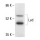 Lad Antibody (H-3) - Western Blotting - Image 411286