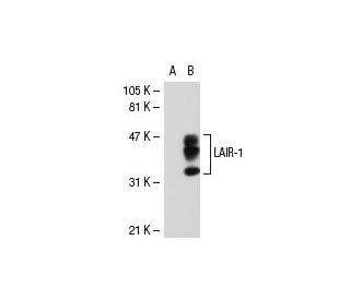 LAIR-1 Antibody (NKTA255) - Western Blotting - Image 31436Each CRISPR/Cas9 Knockout (KO) Plasmid product consists of a pool of 3 plasmids designed to ensure identification and cleavage of a specific gene for maximum knockout efficiency. Each plasmid encodes a unique 20 nt sequence derived from the GeCKO (v2) library.