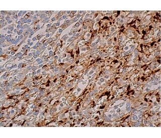 LAL Antibody (9G7F12) | SCBT - Santa Cruz Biotechnology