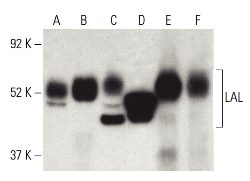 LAL Antibody (9G7F12) | SCBT - Santa Cruz Biotechnology