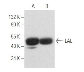 LAL Antibody (9G7F12) - Western Blotting - Image 357124