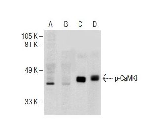 Western blot analysis of CaMKI phosphorylation in untreated (A,C) and lambda protein phosphatase (sc-200312A) treated (B,D 
