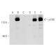 Western blot analysis of FAK phosphorylation in non-transfected: sc-117752 (A,D), untreated human FAK transfected: sc-1146