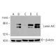 Lamin A/C Antibody (2A1): sc-517580. Western blot analysis of Lamin A/C expression in untreated HeLa (A), chemically-treated HeLa (B), untreated HCT-116 (C) and chemically-treated HCT-116 (D, E) whole cell lysates. Detection reagent used: m-IgG<sub>2b</sub> BP-HRP: sc-542741. β-Actin (C4): sc-47778 used as loading control. Detection reagent used: m-IgG Fc BP-HRP: sc-525409. Lamin A/C Antibody (2A1) - Western Blotting - Image 416467