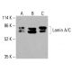 Lamin A/C Antibody (4C11): sc-517579. Western blot analysis of Lamin A/C expression in HeLa (A), K-562 (B) and HCT-116 (C) whole cell lysates. Detection reagent used: m-IgG Fc BP-HRP: sc-525409. Lamin A/C Antibody (4C11) - Western Blotting - Image 416468