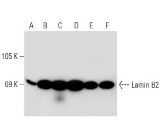 Lamin B2 Antibody (LN43) - Western Blotting - Image 129622