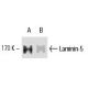 Laminin-5 Antibody (P3E4) - Western Blotting - Image 9529