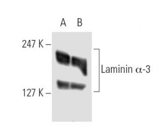 Laminin-5 Antibody (P3H9-2) - Western Blotting - Image 9051 