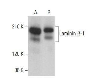 Laminin &beta;-1 Antibody (LT3) - Western Blotting - Image 380895 