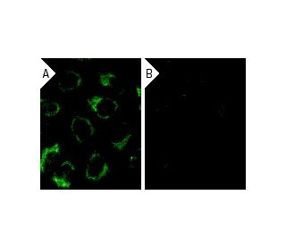 Laminin &beta;-1 siRNA (h): sc-29387. Immunofluorescence staining of methanol-fixed, control HeLa (A) and Laminin &beta;-1 