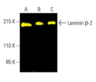 Laminin &beta;-2 Antibody (C4) - Western Blotting - Image 403322 