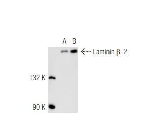 Laminin beta-2 (SPM412): sc-56421. Western blot analysis of Laminin beta-2... 