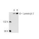 Laminin beta-2 (SPM412): sc-56421. Western blot analysis of Laminin beta-2... 
