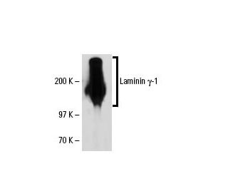 Laminin &gamma;-1 Antibody (3E10) - Western Blotting - Image 19527 