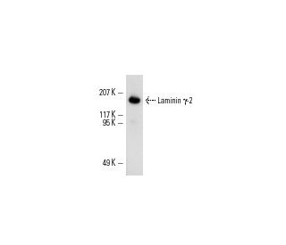 Laminin &gamma;-2 Antibody (B-2) - Western Blotting - Image 5314 